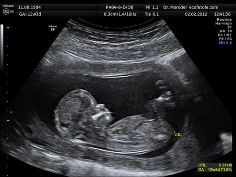Debunking Abortion Arguments